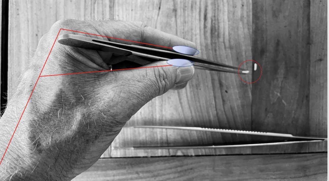 David_ukan's tweet photo. Check out this event: 'Forceps - fingers and fidelity' on @MedAllApp 👇 https://t.co/jMaq0jGiC5 Live at 1600 hrs BST on 16 September 2024 on @MedAllApp and accredited by @RCSEd.  Apply knowledge of functional anatomy to 'home' your surgical skills - delegates from 119 countries! https://t.co/pQDBLodYoX