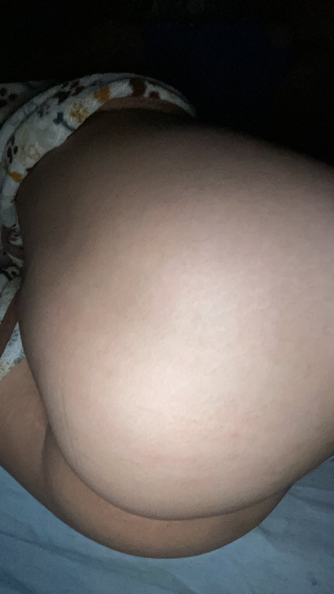 RT