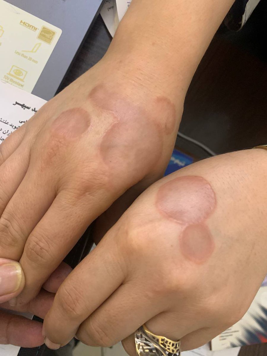 Dr.Haitham Hamoud | د.هيثم tweet media