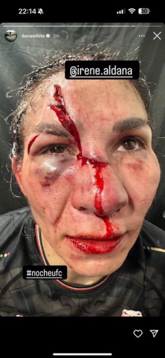 Noti UFC tweet media