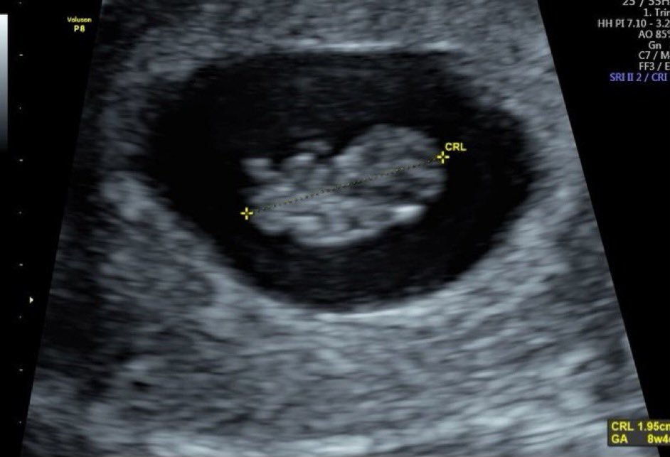 I'm naming her yeahits4th if the wife lets me!