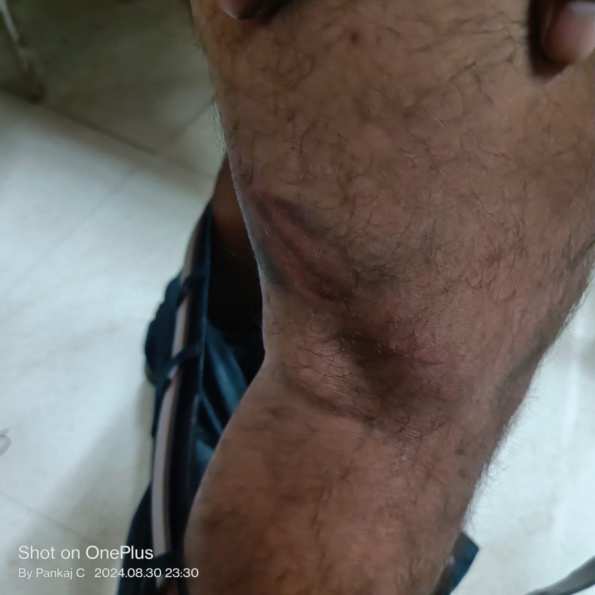 Pramod_Shinde09's tweet photo. @nilesh_pawar15 @nsitharaman Almost a month has passed since the heinous attack on bank employees, yet 6 culprits remain at large. It's high time authorities take swift action to ensure justice&amp; protect our workforce.#Stop_Attacks_On_Bankstaff @mieknathshinde @ABPNews @TV9Marathi 
@DGPMaharashtra @RRPSpeaks https://t.co/jJgfRJdW8q