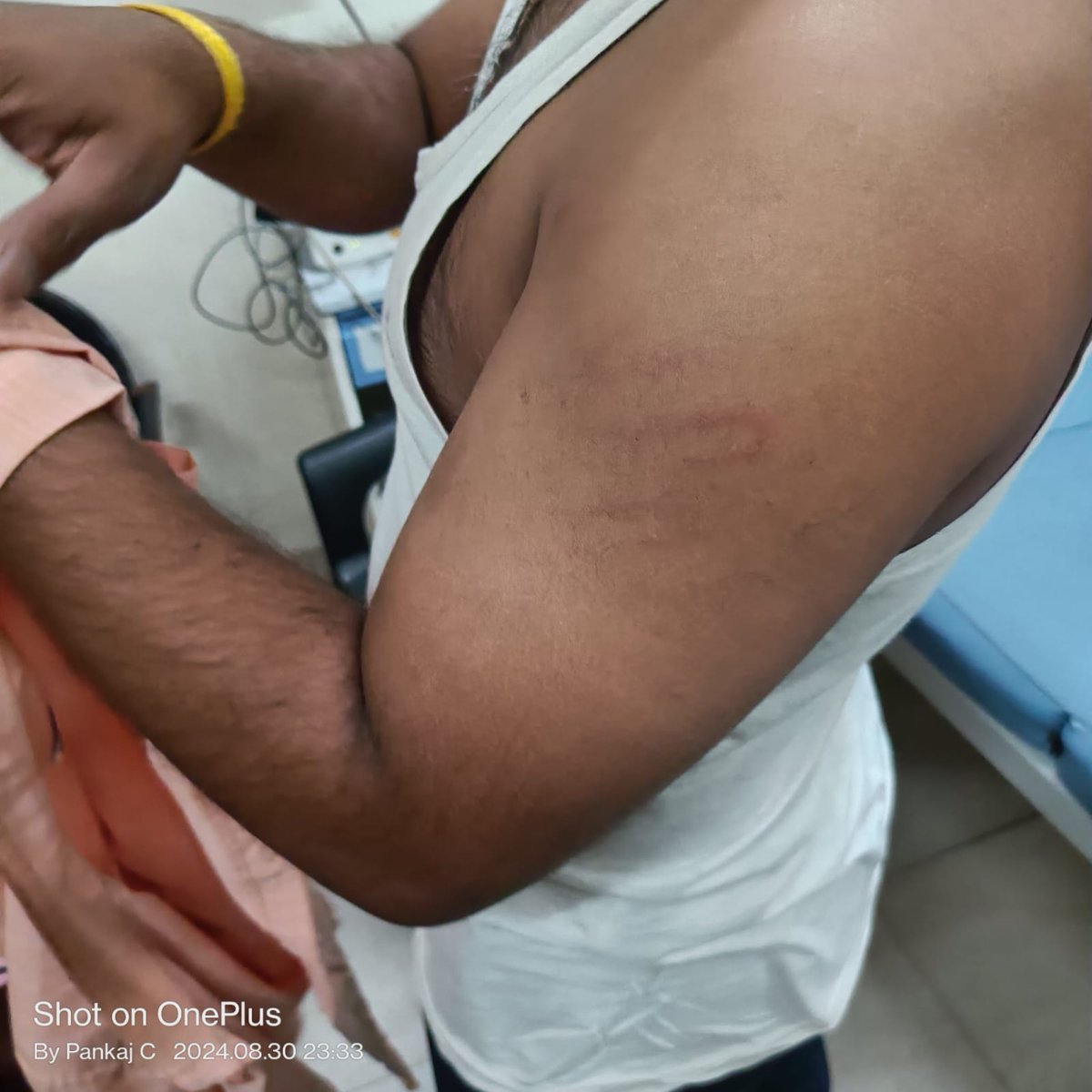 Pramod_Shinde09's tweet photo. @nilesh_pawar15 @nsitharaman Almost a month has passed since the heinous attack on bank employees, yet 6 culprits remain at large. It's high time authorities take swift action to ensure justice&amp; protect our workforce.#Stop_Attacks_On_Bankstaff @mieknathshinde @ABPNews @TV9Marathi 
@DGPMaharashtra @RRPSpeaks https://t.co/jJgfRJdW8q