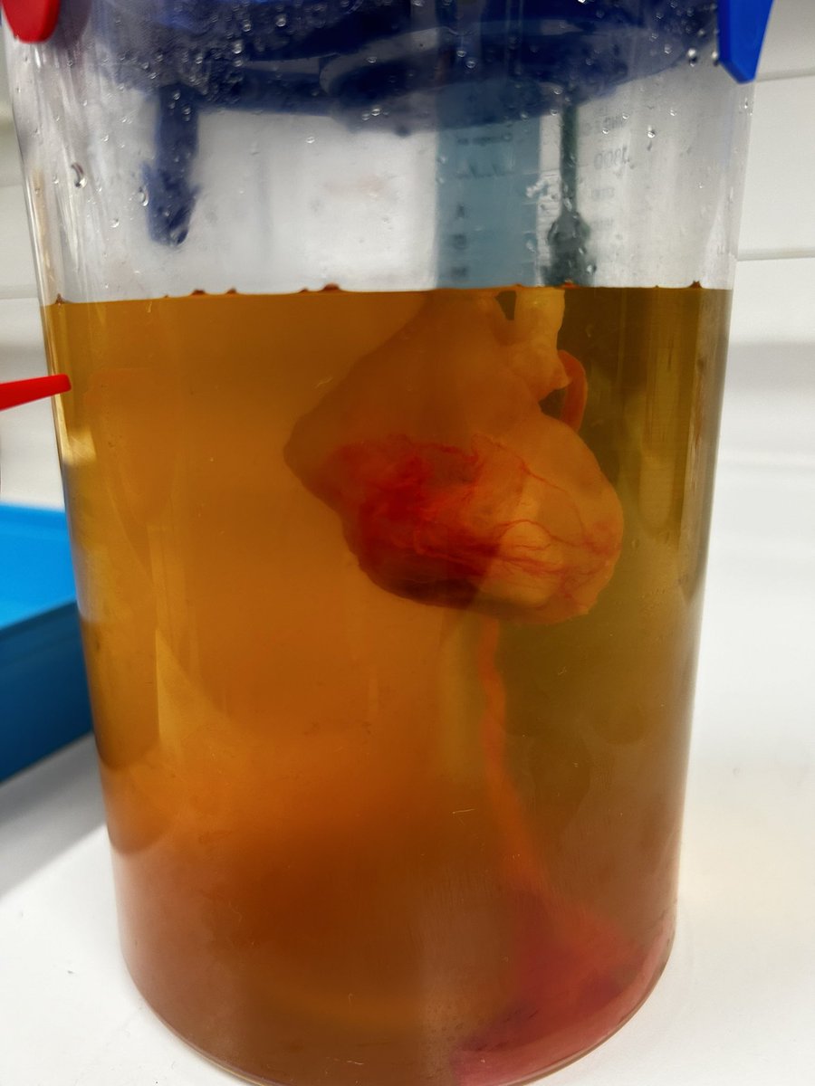 MBHT Pleural Team tweet media