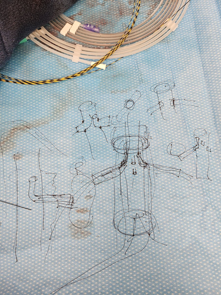 FarwahiqbalPhD's tweet photo. I have learned so much in the past 3 weeks at @StanfordVasc. My attendings, fellows and residents have allowed me to assist in every surgery. The OR techs are incredible, they have helped me tremendously. Assisted in my first TAMBE!! https://t.co/V7bq9yqmYH