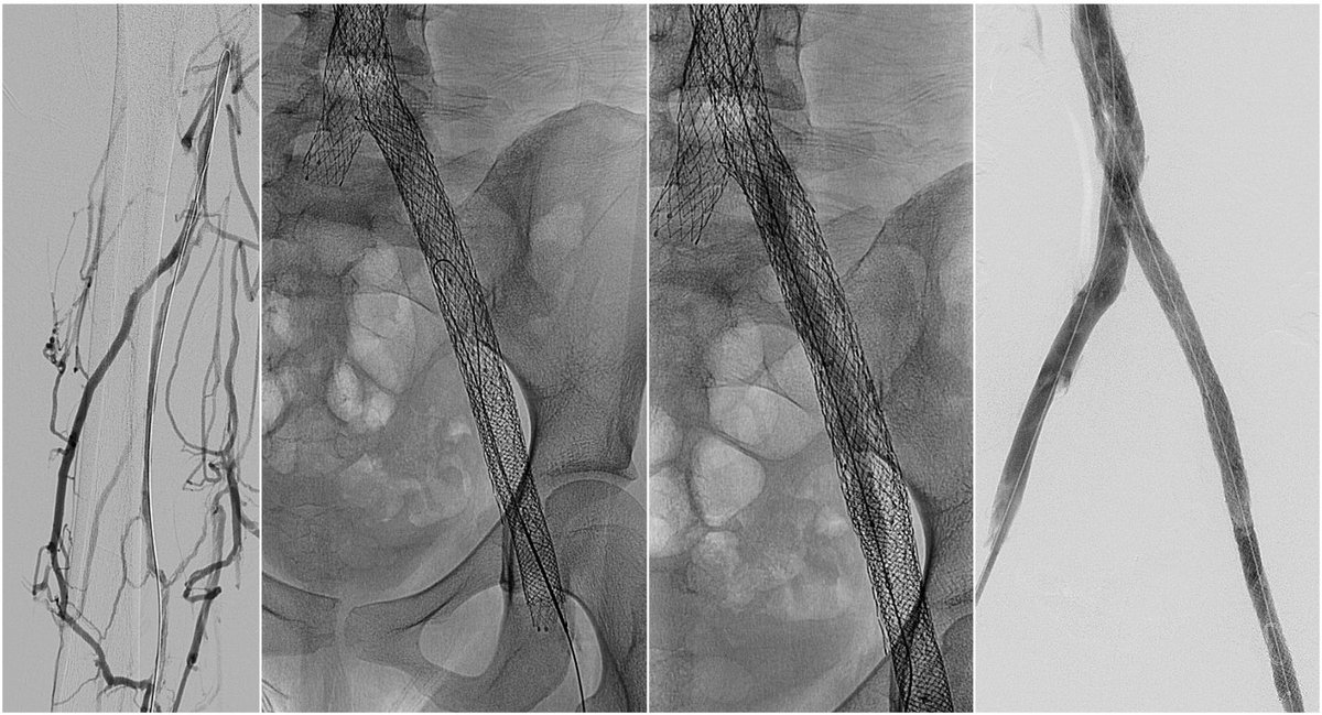 Jeffrey F. B. Chick, MD, MPH tweet media