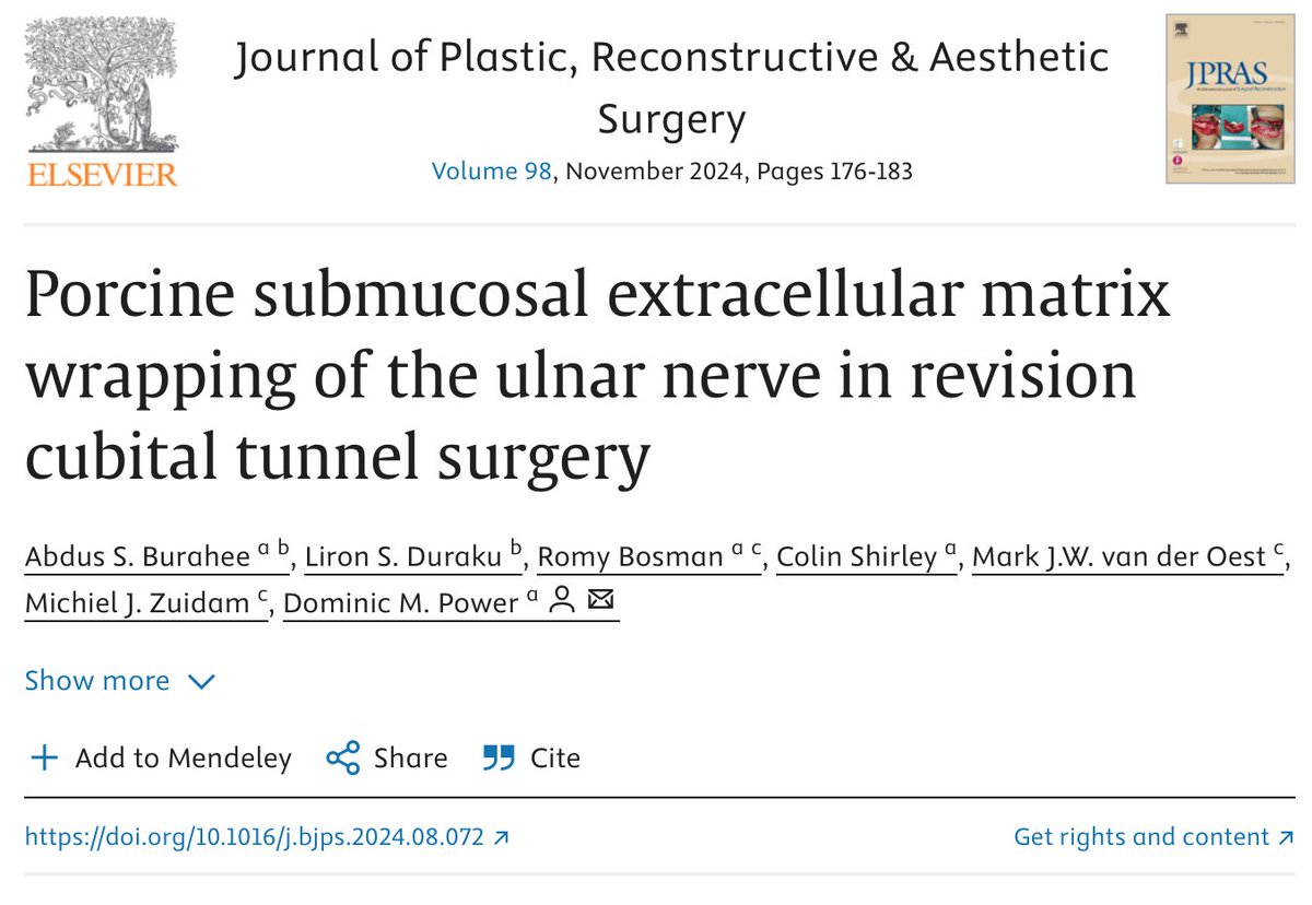Revision cubital túnel is challenging due to scar tether and impaired nerve glide. This latest HaPPeN publication describes our experience with PECM collagen wrapping.