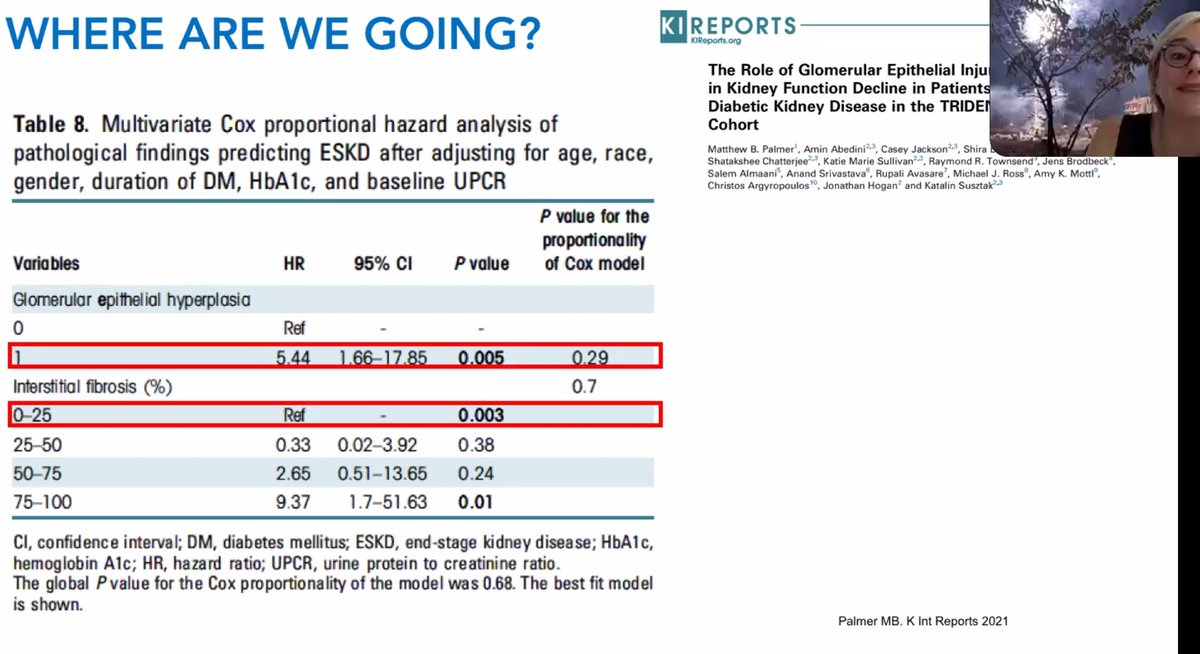 Sheila Bermejo (@shbermejo) on Twitter photo Nice sunday afternoon: biopsy or not biopsy diabetic patients. <a href="/PepaSolerR/">Maria Jose Soler</a> presenting our results of spanish cohort of biopsed diabetic patients. Excellent talk, congratulations!! <a href="/GlomCon/">GlomCon</a> <a href="/GlomConILA/">GlomCon Ibero-LatinoAmérica</a> <a href="/NefrologiaVH/">Nefrologia Hospital Universitari Vall d'Hebron</a> <a href="/vallhebron/">Vall d'Hebron</a> <a href="/SENefrologia/">S.E.N. Nefrología</a> <a href="/nefrocat/">Societat Catalana de Nefrologia</a> <a href="/ERAkidney/">ERA - European Renal Association</a> <a href="/KidneyNews/">ASN Kidney News</a> Nice sunday afternoon: biopsy or not biopsy diabetic patients. <a href="/PepaSolerR/">Maria Jose Soler</a> presenting our results of spanish cohort of biopsed diabetic patients. Excellent talk, congratulations!! <a href="/GlomCon/">GlomCon</a> <a href="/GlomConILA/">GlomCon Ibero-LatinoAmérica</a> <a href="/NefrologiaVH/">Nefrologia Hospital Universitari Vall d'Hebron</a> <a href="/vallhebron/">Vall d'Hebron</a> <a href="/SENefrologia/">S.E.N. Nefrología</a> <a href="/nefrocat/">Societat Catalana de Nefrologia</a> <a href="/ERAkidney/">ERA - European Renal Association</a> <a href="/KidneyNews/">ASN Kidney News</a>