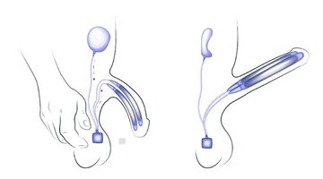 carlos_muscul's tweet image. ¿Quieres mejorar tu Energía y Libido?

Estos ejercicios KEGEL (video en comentarios) Potenciarán tu Energía y subirán tu Libido.

Hilo 👇