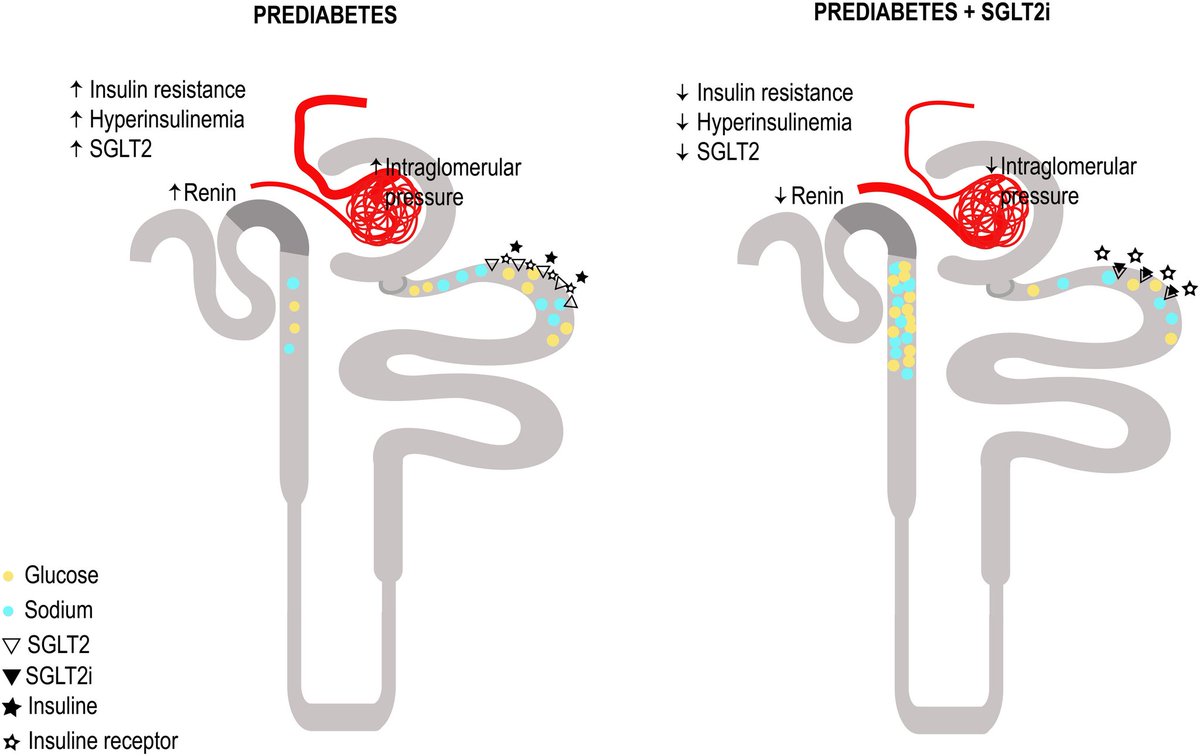 ZHeart11768530's tweet photo. 🔴Prediabetes and CKD: Does a causal relationship exist⤵️ #2024Review #OpenAccess
🔹https://t.co/77kEslqPc7
#Cardiologyexplained #FOAMed #MedEd #medstudent #paramedic #Cardiology #CardioEd #medtwitter #meded #CardioTwitter #cardiotwiteros #MedX #cardiovascular #MedTwitter https://t.co/YFe1UBp7lE