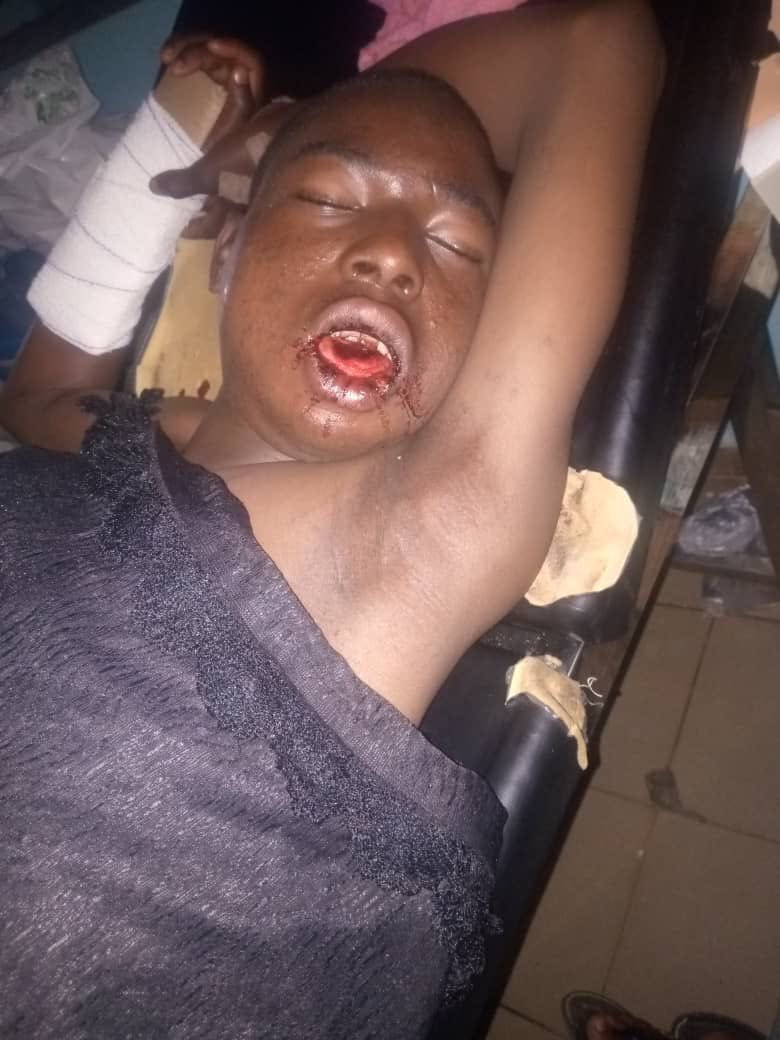 Adamthallith's tweet image. I am here again dear good people of twitter, on behalf of this little boy here, he goes by the name Abdulraheem Semiu, a 15 years old boy, who has been the one taking care of the business his family are feeding on since the unfortunate incident of their father. 

Unfortunately,…