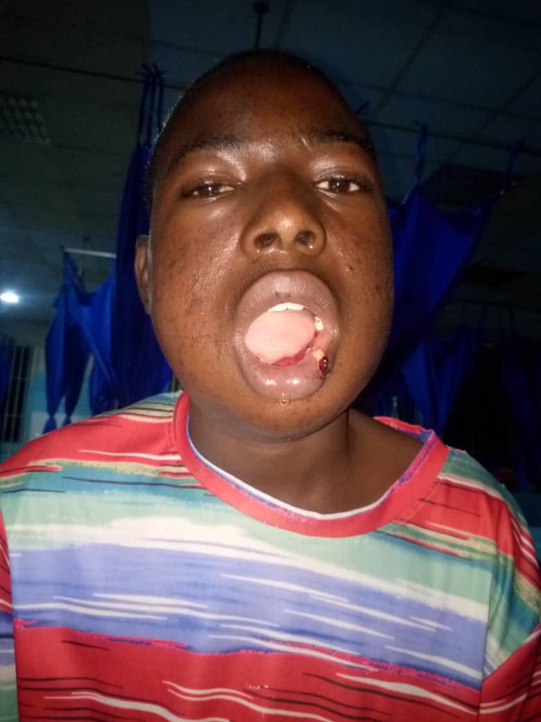 Adamthallith's tweet image. I am here again dear good people of twitter, on behalf of this little boy here, he goes by the name Abdulraheem Semiu, a 15 years old boy, who has been the one taking care of the business his family are feeding on since the unfortunate incident of their father. 

Unfortunately,…