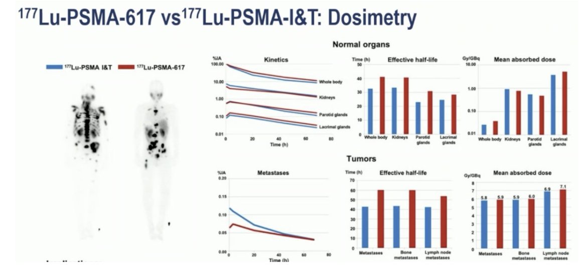urotoday's tweet photo. #InvitedDiscussant: Efficacy of #SPLASH and #UpFrontPSMA trials. Presentation by Irene Burger. #ESMO24 written coverage by @RKSayyid > https://t.co/hQKVgPlgoZ @myESMO https://t.co/UDdF0rErq5
