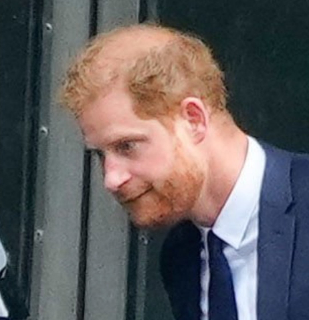 2wisewolves's tweet image. Lmfao at all the IAN hypocrites using the heavily photoshopped photos to pretend they care about this abusive lying dimwitted drug addict ffs not a one of them will care after a divorce from the &quot;let&quot; narcissit #PrinceHarryturns40 a shame he is also abused by #DuchAssDifficult