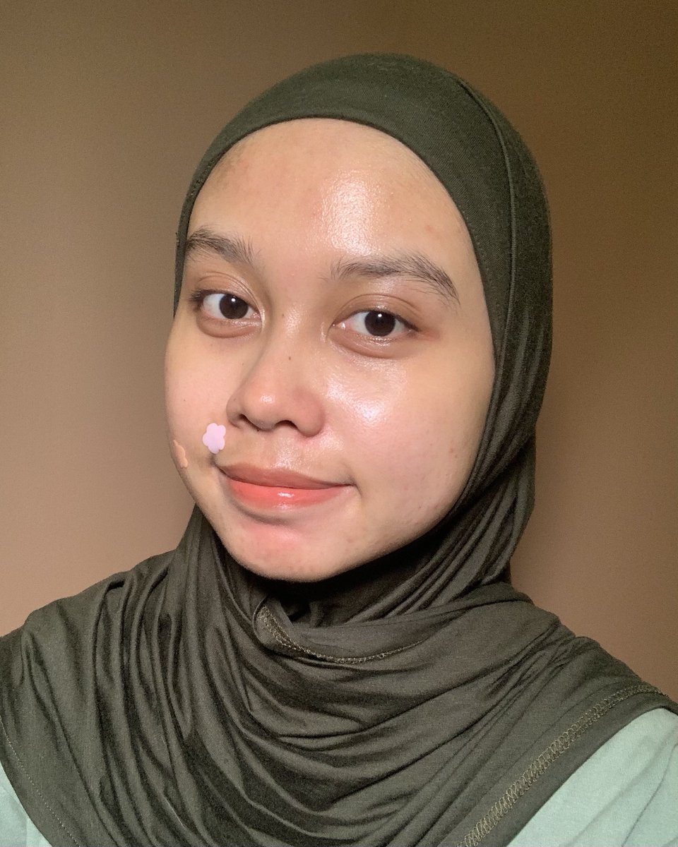 ermi_fn's tweet photo. Kalo pake acne patch tuh meski lagi ada jerawat tetep pengen selfie mulu rasanya 😭💗

gemesh bangettt!!! 🥺🥺💗💗💗 https://t.co/gETjnP9LcZ