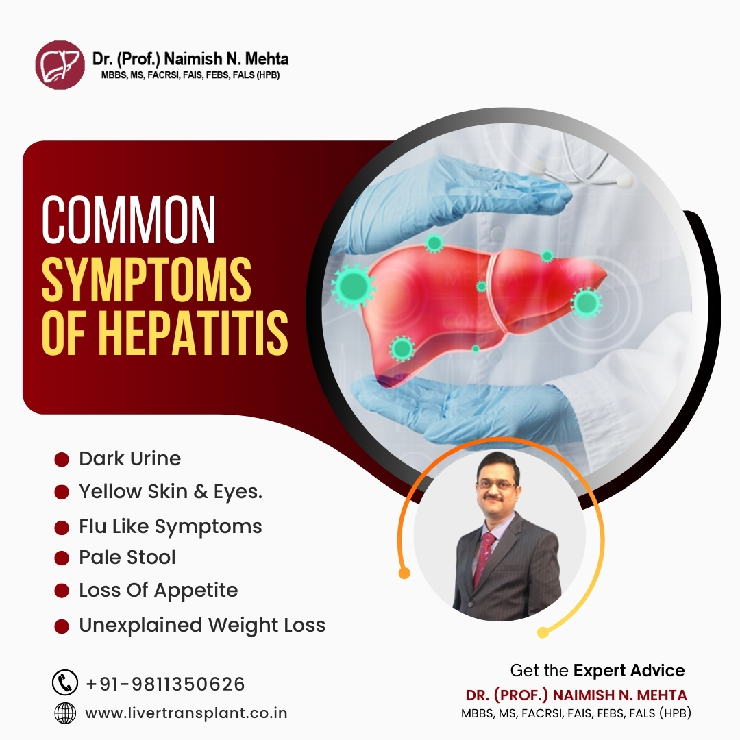 mehta_naimish's tweet image. Common Symptoms Of HEPATITIS
Dark Urine
Yellow Skin &amp;amp; Eyes
Flu-Like Symptoms
Unexplained Weight Loss
Loss Of Appetite
Pale Stool

#hepetitis #LiverProblem #LiverSpecialist #liver #health #cancer #hepatitisc #hepatitisb #DrNaimishMehta
