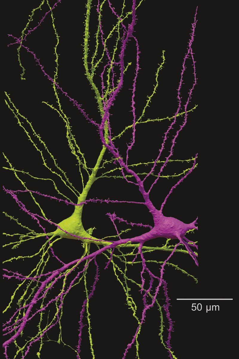 #ElhuyarAldizkaria AZKEN ZENBAKIA
Garunaren milimetro kubiko bat #Ikusmiran
aldizkaria.elhuyar.eus/ikusmiran/garu…