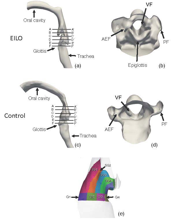 #ArticlesInPress, Application of computational fluid dynamics to investigate pathophysiological mechanisms in exercise-induced laryngeal obstruction  

<a href="/LReidAnatomy/">Luke Reid</a> , et al. 
 🖱️ ow.ly/cAeq50TmPcC
 #JAPPL #ExerciseInducedLaryngealObstruction @emilwalsted
