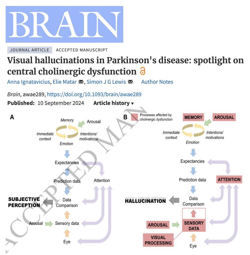 Should we talk more about visual hallucinations in Parkinson's disease and central cholinergic dysfunction? Should we be developing more therapies aimed at cholinergic dysfunction. Ignatavicius, Lewis and colleagues <a href="/Brain1878/">Brain</a> have a GREAT article on the topic which is a
