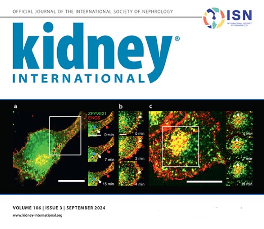Kidney_Int's tweet photo. Have you checked out the September issue of #Kidney_Int?
🌟SGLT2i and the afferent arteriole
🌟Podocytes in obesity-related glomerulopathy
🌟Identifying genetic variants of ADPKD by urine
transcriptomics
And more!📖
https://t.co/G8agNPrcNy https://t.co/4zkOH5jaKQ