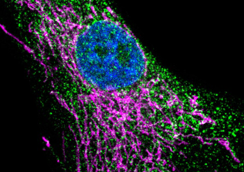Inserm's tweet photo. Une équipe de recherche #Inserm a mis en évidence une mutation #génétique rare mais récurrente, à l’origine d’un trouble complexe, touchant plusieurs #organes et associé à une immunodéficience sévère.

Lire le communiqué : https://t.co/glfTNLHByk https://t.co/dEI9BlRgWp