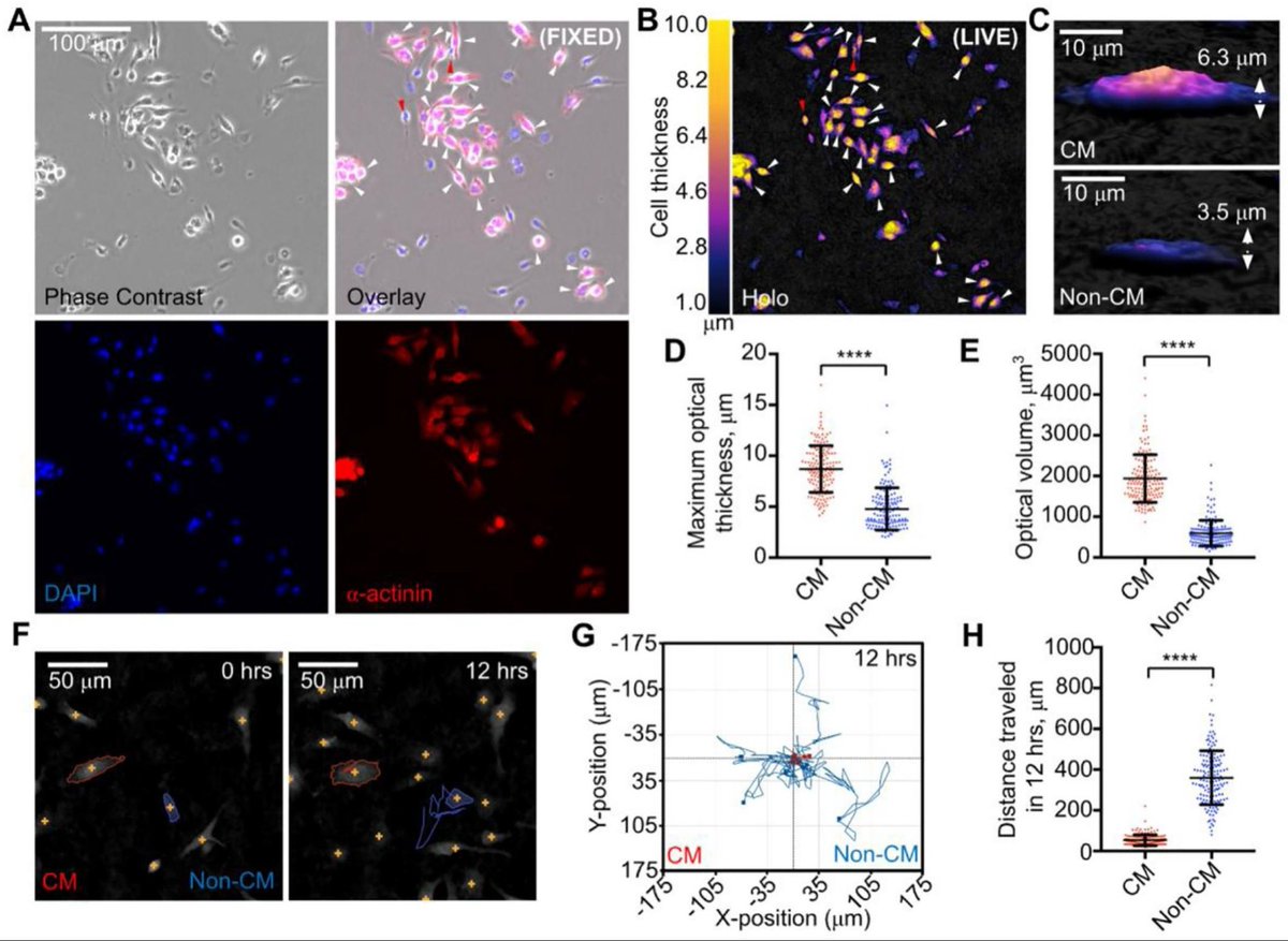 GuoHuangLab(黄果实验室)@UCSF #Open postdoc position (@guonhuang) on Twitter photo <a href="/JosephJCMoreno/">Joseph Moreno</a> <a href="/skhyeam/">Shea Khyeam</a> <a href="/UCSF/">UC San Francisco</a> <a href="/MIT/">Massachusetts Institute of Technology (MIT)</a> how to tell cardiomyocytes (CMs) and non-CMs apart? It turns out that CMs have much larger optical volume (Fig. E) and shorter distance traveled (Fig. H). <a href="/JosephJCMoreno/">Joseph Moreno</a> <a href="/skhyeam/">Shea Khyeam</a> <a href="/UCSF/">UC San Francisco</a> <a href="/MIT/">Massachusetts Institute of Technology (MIT)</a> how to tell cardiomyocytes (CMs) and non-CMs apart? It turns out that CMs have much larger optical volume (Fig. E) and shorter distance traveled (Fig. H).