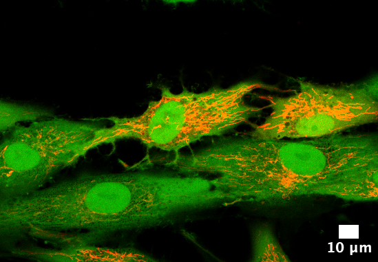 Bonassar Lab (@bonassarlab) on Twitter photo Congratulations to Ashley Cardenasย @Ashleycardalv for winning the 2024 <a href="/RoosterBio/">RoosterBio</a> Developmentย Award for her proposal titled "MSC Mitochondria for the Treatment of Degenerative Disc Disease." This award will provide $10K in RoosterBio cells and reagents to support her work. Congratulations to Ashley Cardenasย @Ashleycardalv for winning the 2024 <a href="/RoosterBio/">RoosterBio</a> Developmentย Award for her proposal titled "MSC Mitochondria for the Treatment of Degenerative Disc Disease." This award will provide $10K in RoosterBio cells and reagents to support her work.