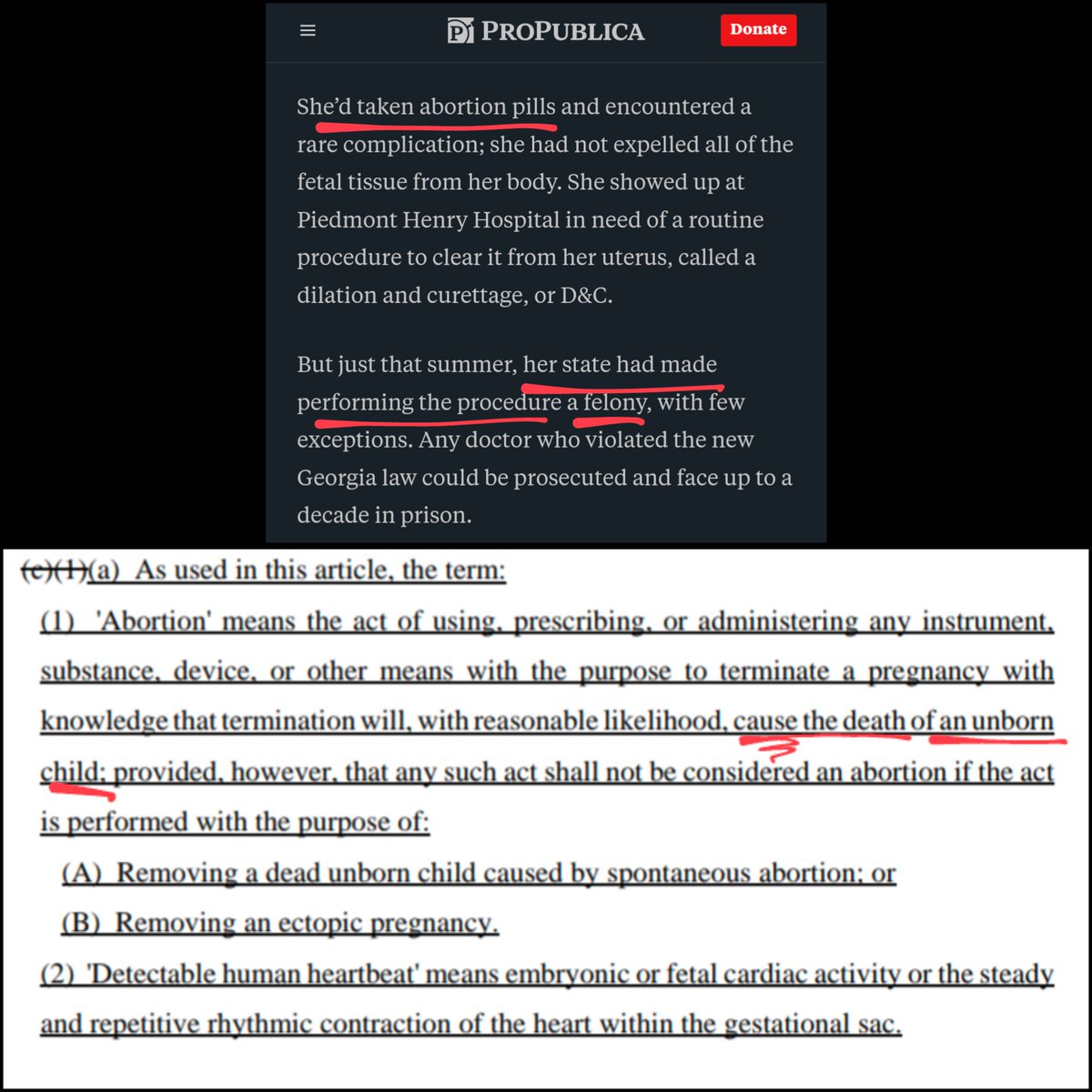 Georgia's abortion law didn't make a D&amp;C in Thurman's situation a felony. It doesn't prevent interventions if either (1) there's no detectable heartbeat or (2) there's a medical emergency. Thurman's situation checks both boxes.

A woman died from medical incompetence after