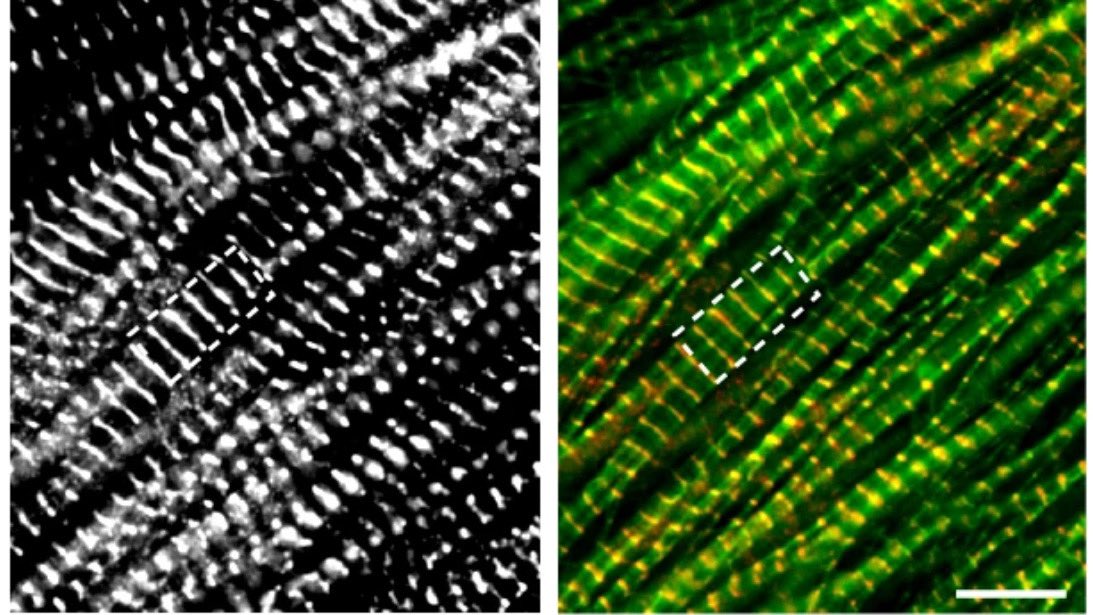 Jared Churko (@heartresearchus) on Twitter photo Excited to share results from our collab with the Gregorio lab to understand neonatal dilated cardiomyopathy (Lmod2) through integration of mouse models, iPSCs, CRISPR gene editing, EHTs, calcium imaging, and transcriptomics <a href="/JessikaIwanski/">Jessika Iwanski, MD PhD</a> <a href="/Nature_NPJ/">npj Journals</a> rdcu.be/dT5TE Excited to share results from our collab with the Gregorio lab to understand neonatal dilated cardiomyopathy (Lmod2) through integration of mouse models, iPSCs, CRISPR gene editing, EHTs, calcium imaging, and transcriptomics <a href="/JessikaIwanski/">Jessika Iwanski, MD PhD</a> <a href="/Nature_NPJ/">npj Journals</a> rdcu.be/dT5TE