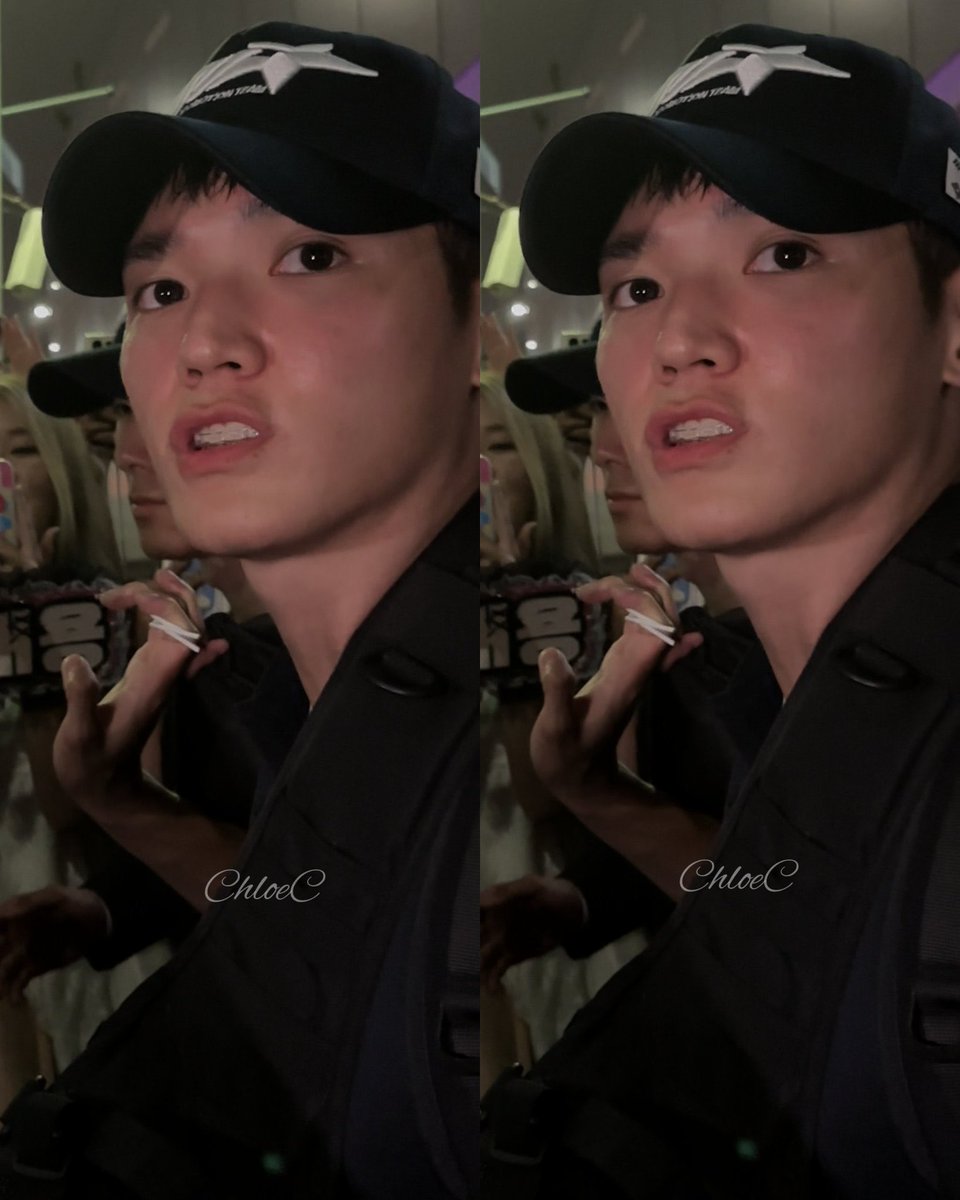 bubu_jy's tweet image. กรี๊ดดดดดดดดดดดด น้องแทยงฟันเหล็กแบบชัดๆ!!!