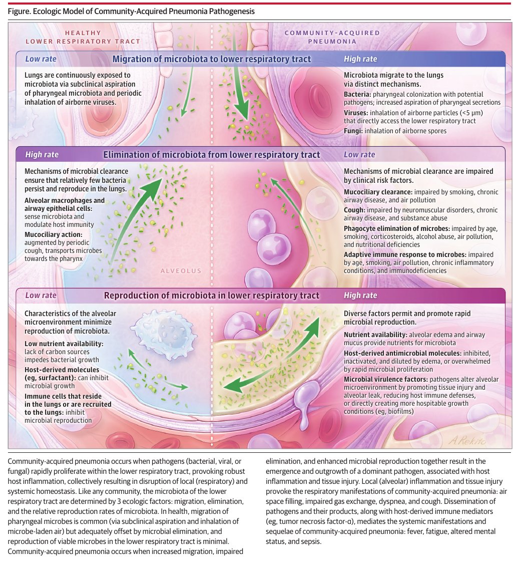 MHcsba's tweet photo. JAMA 2024: Review Neumonia adquirida en la comunidad 
#MedEd #MedTwitter #MedX
doi:10.1001/jama.2024.14796
https://t.co/cL7saZNryb https://t.co/Uu0XFxa1d3