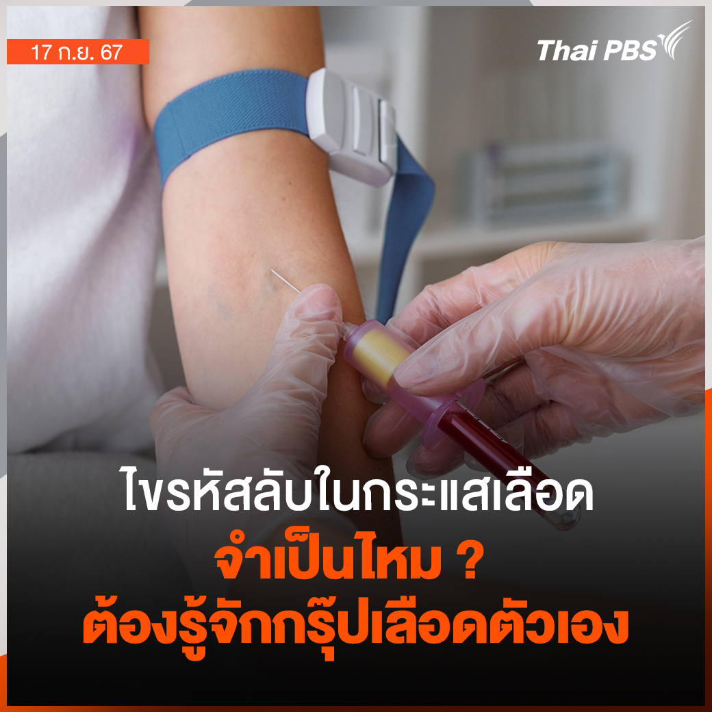 ThaiPBSSciTech's tweet image. #กรุ๊ปเลือด #ข้อมูลชีวภาพ สำคัญใช้ดูแลสุขภาพ ทั้งการถ่ายเลือด การรักษา การตั้งครรภ์ ยังบ่งบอกถึงความเชื่อมโยงทางพันธุกรรมระหว่างสมาชิกในครอบครัว การเข้าใจและรู้จักกรุ๊ปเลือดของตัวเองและคนในครอบครัวจะช่วยดูแลสุขภาพได้อย่างมีประสิทธิภาพ

กรุ๊ปเลือด (#BloodType)