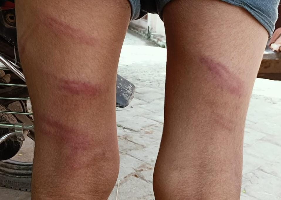 Three Dalit children were playing outside the temple, which angered the caste Hindu people, the Jatankwadis took the children hostage and beat them brutally. The incident happened in the mainpuri district of uttar pradesh.