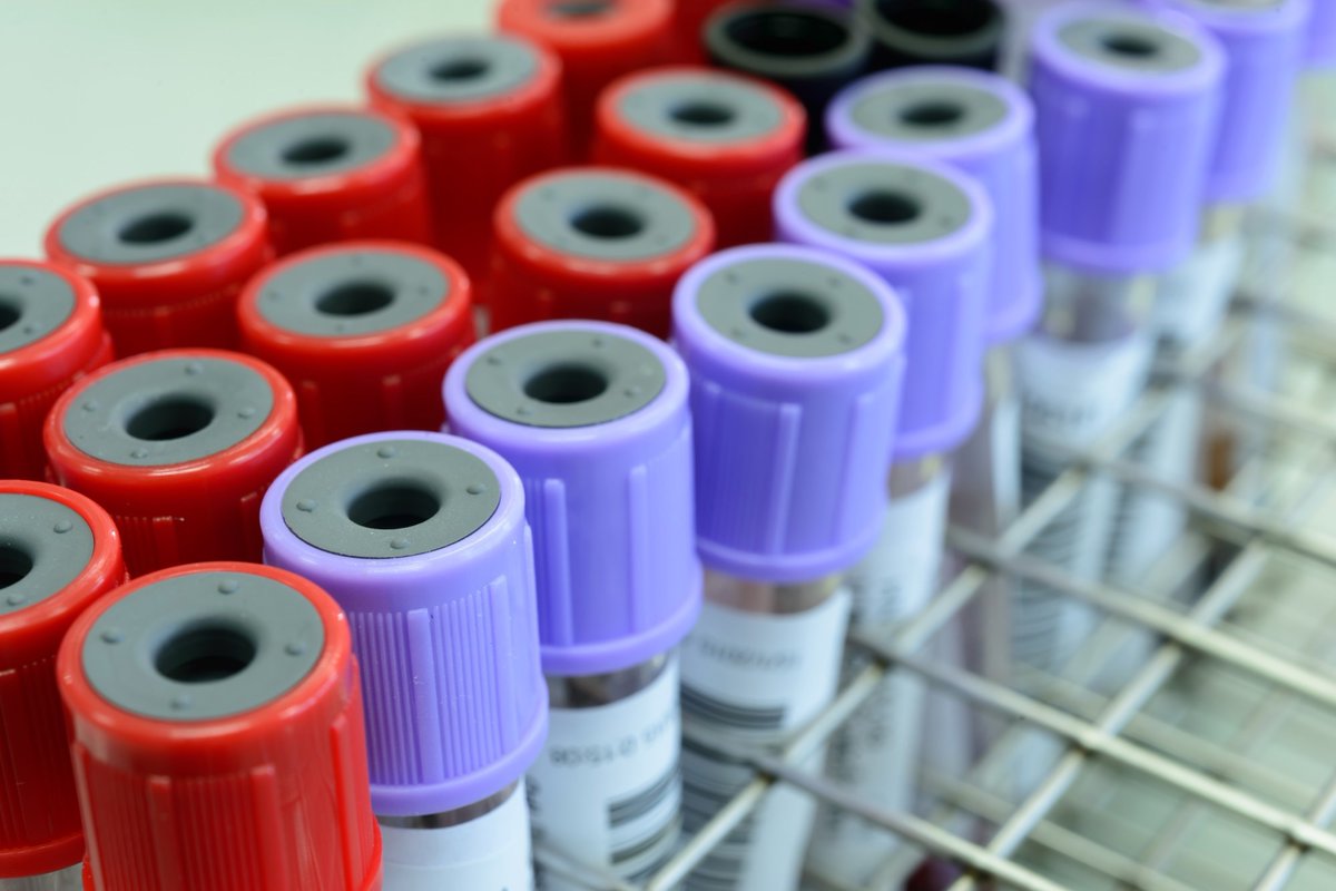 NewsMedical's tweet image. 🔍✨ Meet MILTON: a groundbreaking framework enhancing disease prediction through biobank datasets! Discover how it identifies 3,213 diseases and revolutionizes health insights. 

Read more: news-medical.net/news/20240917/… 

@NatureGenet #HealthTech #Biobanks #MachineLearning