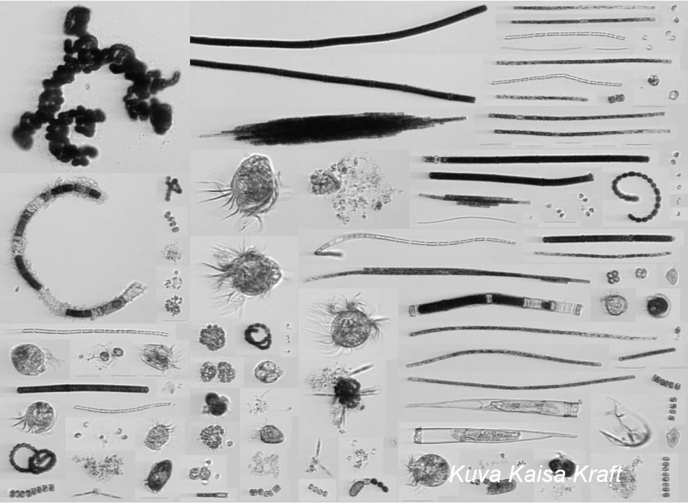 Plankton diversity in the Baltic Sea, photographed using the Imaging Flow CytoBot. Photo Kaisa Kraft.