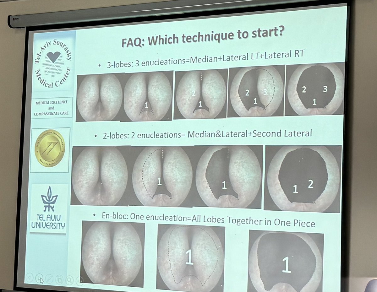 Kremena Petkova (@petkovakremena) on Twitter photo Prof. Sofer presenting the basics of HoLEP during the BSci HoLEP Academy at Military Medical Academy, Sofia. <a href="/mario_sofer/">Mario Sofer</a> <a href="/migokce/">Mehmet Ilker Gökce</a> <a href="/IliyaSaltirov/">Iliya Saltirov</a> <a href="/bsc_urology/">Boston Scientific Urology</a> Prof. Sofer presenting the basics of HoLEP during the BSci HoLEP Academy at Military Medical Academy, Sofia. <a href="/mario_sofer/">Mario Sofer</a> <a href="/migokce/">Mehmet Ilker Gökce</a> <a href="/IliyaSaltirov/">Iliya Saltirov</a> <a href="/bsc_urology/">Boston Scientific Urology</a>