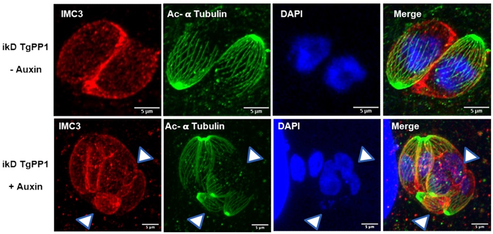 PLOS Biology (@plosbiology) on Twitter photo Apicomplexan #parasite division: <a href="/MGissot/">Mathieu Gissot</a> &co show that the #phosphatase TgPP1 in #Toxoplasma regulates the #CellCycle & amylopectin accumulation by dephosphorylating inner membrane complex & starch-binding domain proteins #PLOSBiology plos.io/3XwMYgj Apicomplexan #parasite division: <a href="/MGissot/">Mathieu Gissot</a> &co show that the #phosphatase TgPP1 in #Toxoplasma regulates the #CellCycle & amylopectin accumulation by dephosphorylating inner membrane complex & starch-binding domain proteins #PLOSBiology plos.io/3XwMYgj