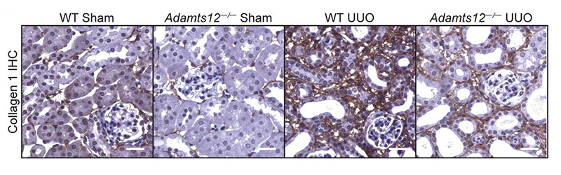 Journal of Clinical Investigation (@jclinicalinvest) on Twitter photo Cells on the move in fibrosis—check out this tour de force study with stunning spatial transcriptomics! jci.org/articles/view/…
<a href="/KonradHoeft/">Konrad Hoeft</a> <a href="/rkramann/">Rafael Kramann, MD PhD</a> & team <a href="/RWTH/">RWTH Aachen</a> report on controlling fibrosis by restructuring the extracellular matrix in kidney and heart fibrosis models. Cells on the move in fibrosis—check out this tour de force study with stunning spatial transcriptomics! jci.org/articles/view/…
<a href="/KonradHoeft/">Konrad Hoeft</a> <a href="/rkramann/">Rafael Kramann, MD PhD</a> & team <a href="/RWTH/">RWTH Aachen</a> report on controlling fibrosis by restructuring the extracellular matrix in kidney and heart fibrosis models.