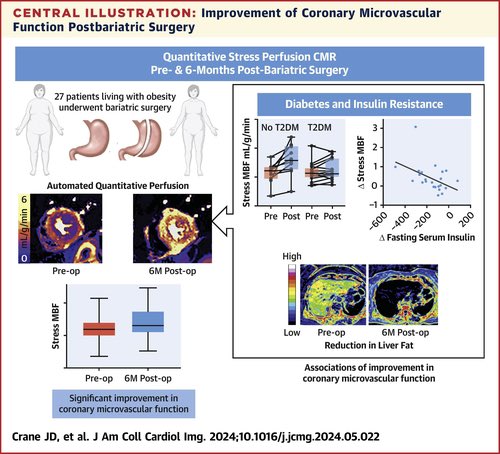 BSCMR (@bscmr) on Twitter photo The Impact of Bariatric Surgery on Coronary Microvascular Function Assessed Using Automated Quantitative Perfusion 🧲
<a href="/JccmoonMoon/">James moon</a> <a href="/drgeorgejoy/">George Joy</a> <a href="/j_d_crane/">James Crane</a> <a href="/mrimypacemaker/">Anish Bhuva</a> <a href="/MariannaFonta11/">Marianna Fontana</a> <a href="/dr_manisty/">Charlotte Manisty</a> <a href="/sven_plein/">Sven Plein</a>
BSCMR president <a href="/SaulMyerson/">SaulMyerson</a> The Impact of Bariatric Surgery on Coronary Microvascular Function Assessed Using Automated Quantitative Perfusion 🧲
<a href="/JccmoonMoon/">James moon</a> <a href="/drgeorgejoy/">George Joy</a> <a href="/j_d_crane/">James Crane</a> <a href="/mrimypacemaker/">Anish Bhuva</a> <a href="/MariannaFonta11/">Marianna Fontana</a> <a href="/dr_manisty/">Charlotte Manisty</a> <a href="/sven_plein/">Sven Plein</a>
BSCMR president <a href="/SaulMyerson/">SaulMyerson</a>