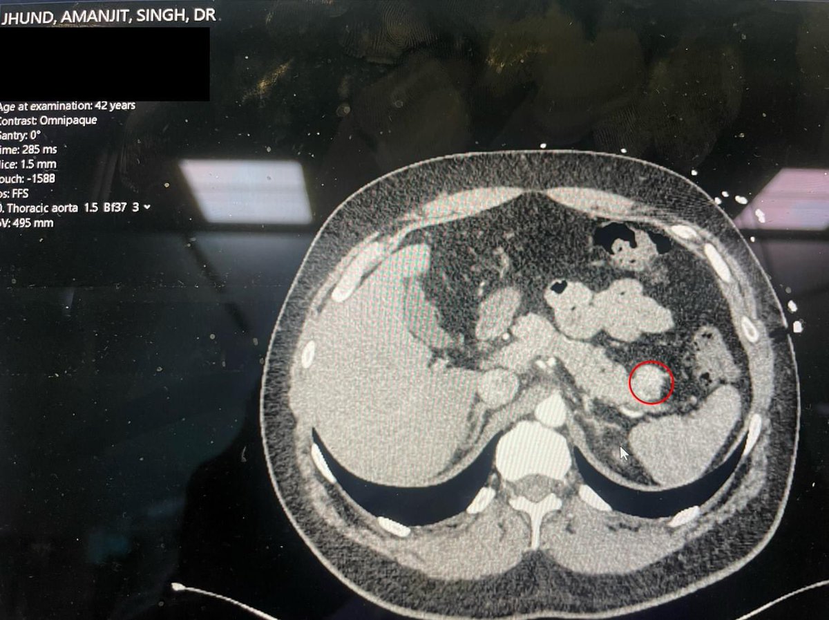 Dr Amanjit Jhund tweet media