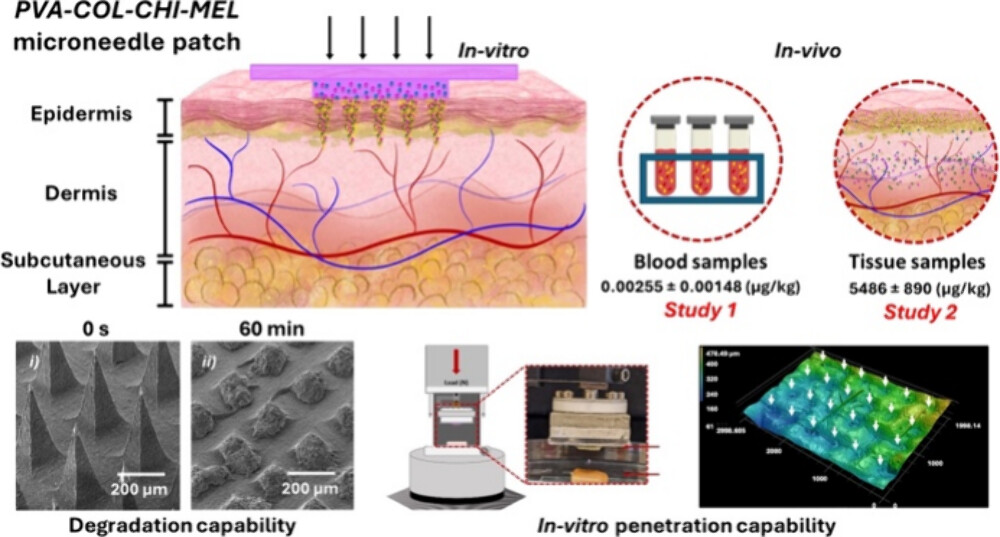 ACS Nano (@acsnano) on Twitter photo Work led by grad student <a href="/Kathy_Miranda18/">Katherine A. Miranda M</a> from <a href="/jorge_almodovar/">Jorge Almodóvar</a> group report on the engineering and characterization of a degradable polymeric microneedle patch of a blend of polymers to deliver meloxicam to manage pain in farm animals.
Read it here 🔗 go.acs.org/aRZ Work led by grad student <a href="/Kathy_Miranda18/">Katherine A. Miranda M</a> from <a href="/jorge_almodovar/">Jorge Almodóvar</a> group report on the engineering and characterization of a degradable polymeric microneedle patch of a blend of polymers to deliver meloxicam to manage pain in farm animals.
Read it here 🔗 go.acs.org/aRZ