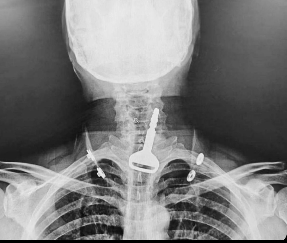 لاتوصيني عليك ولاتشكك فيني
قافلٍ قلبي عليك وبالعٍ مفتاحه