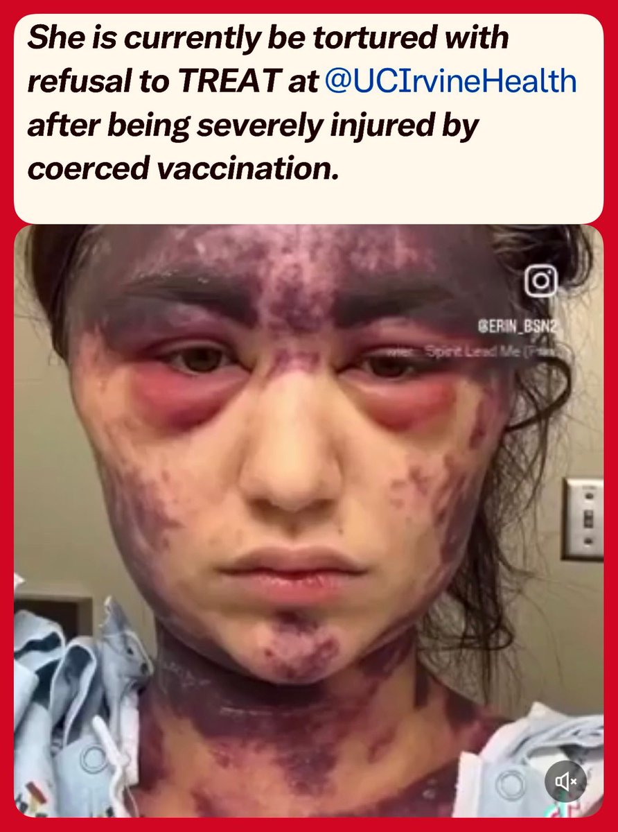 You know why the hospital isn’t treating her? Because hospitals don’t acknowledge vaccine injury, therefore:

1) They have zero clue how to treat it, and

2) Treating it would be admission of guilt.

Let’s hope the family wins a multimillion lawsuit!

Save #alexislorenze 🙏