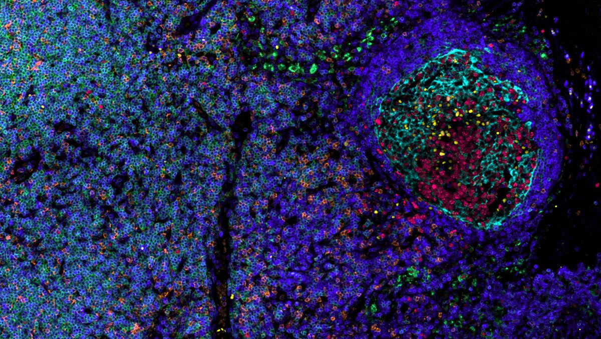 _hubmap's tweet photo. Time to take a deeper #CellDIVE into a lymph node through this IBEX image by #_hubmap researcher Andrea Radtke @Germain lab @NIAIDNews. Lymph nodes house immune cells, like B and T cells, and lymphocytes, as well as filtering out foreign particles, making this organ out of cyte! https://t.co/uDoNWKD1X1