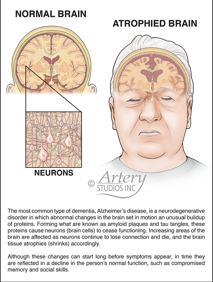 SEPTEMBER IS WORLD ALZHEIMER’S AWARENESS MONTH

#WorldAlzheimersMonth