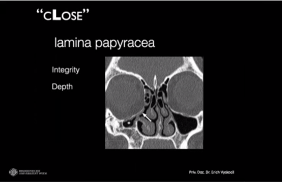 ESHNR (@eshnrsociety) on Twitter photo Importance of „CLOSE“- Algorithm
ASHNR-ESHNR Joint Webinar #HNRadClinical: Rhinology byErich Vyskocil „A sinus surgeon perspective on the preoperative CT”
moderators: Drs. Diana Rodriguez and <a href="/YPekcevik/">Yeliz Pekçevik, MD</a>
<a href="/ASHNRSociety/">ASHNR</a> <a href="/BSHNI_UK/">British Society of Head & Neck Imaging</a> #HNRadClinical <a href="/myESR/">myesr</a> Importance of „CLOSE“- Algorithm
ASHNR-ESHNR Joint Webinar #HNRadClinical: Rhinology byErich Vyskocil „A sinus surgeon perspective on the preoperative CT”
moderators: Drs. Diana Rodriguez and <a href="/YPekcevik/">Yeliz Pekçevik, MD</a>
<a href="/ASHNRSociety/">ASHNR</a> <a href="/BSHNI_UK/">British Society of Head & Neck Imaging</a> #HNRadClinical <a href="/myESR/">myesr</a>