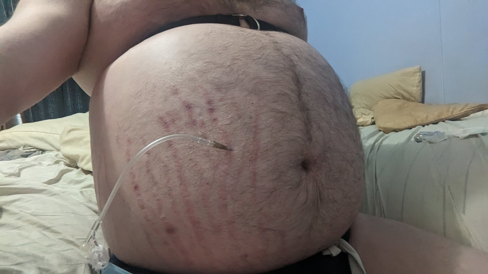 3 pic. Decided to do an extended N2O blimp session. Tied off my chest and my waist https://t.co/xsgKcokiWH