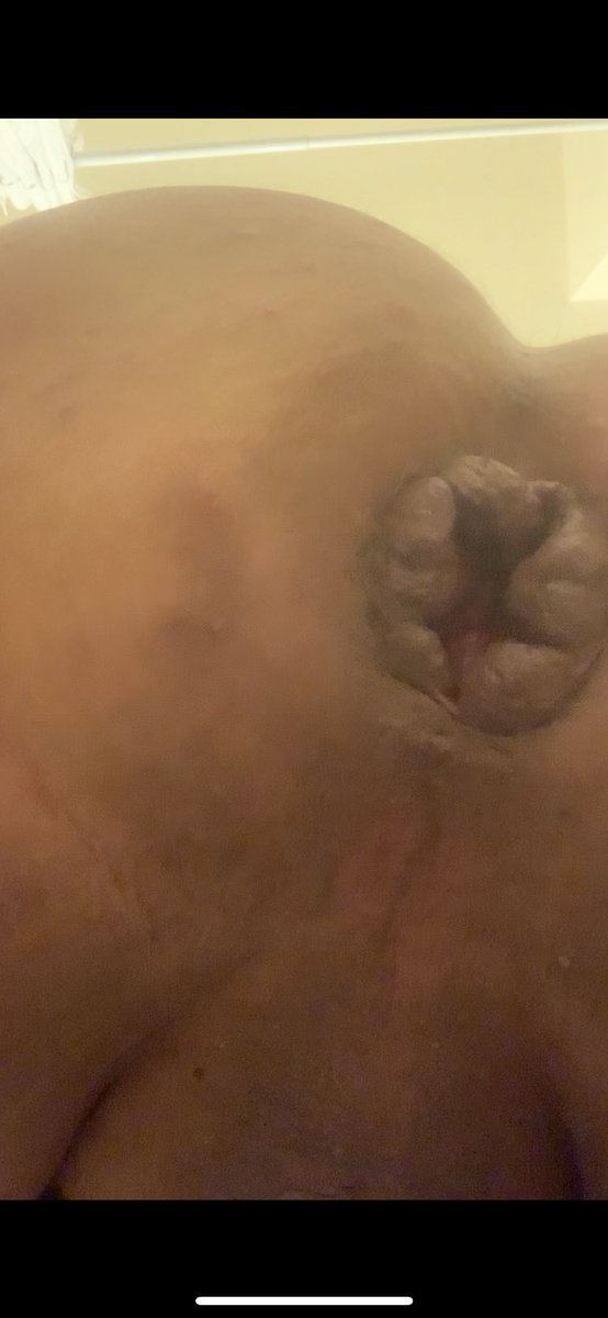 sissycumslutCC3's tweet photo. Oh my fucking god it looks like itโs gunna fall out doesnt it?! #prolapse #loosefag #loosesissy #gaped #stretched #cunted #broken #loose #wornout #trained https://t.co/VRkKWeasbA