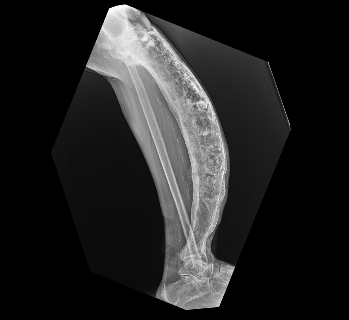 Sam Ghali, M.D. tweet media