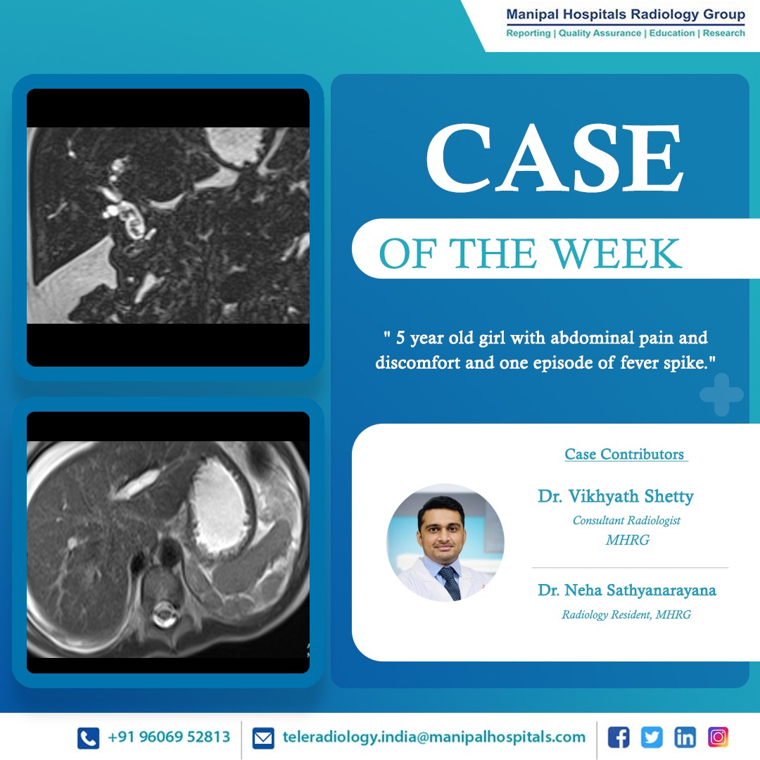 ManipalMhrg's tweet photo. Presenting our #CaseOfTheWeek- A-5-year-old girl with abdominal pain and discomfort and one episode of fever spike.
Know More: https://t.co/7eoVBnEaCB https://t.co/kpDbXgHUSc